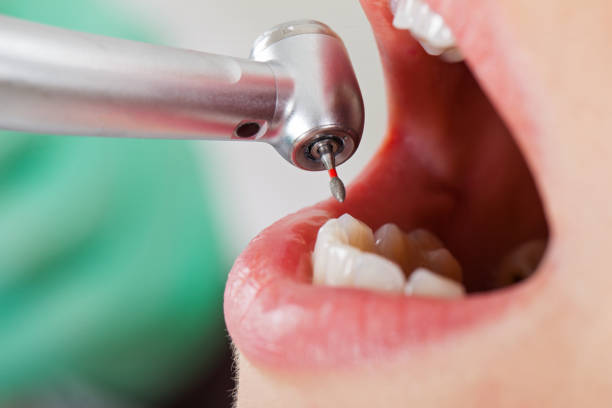 Best Emergency Broken Tooth Repair in Farmers Branch, TX